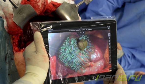 iPad ассистировал хирургам из Бремена